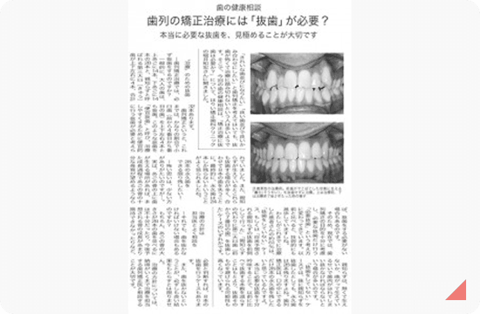 歯列矯正治療には「抜歯」が必要？　記事