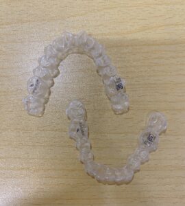 実際のエンジェルアライナー